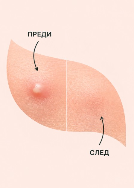 Сет „Banga-banga“ против пъпки - Image 2